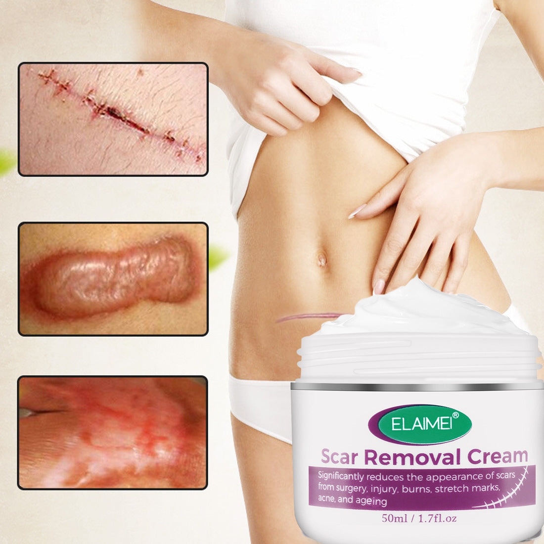 Crema viso Skin Rebound Scarless, cicatrici, cicatrici da acne, smagliature